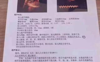 孕妇小排畸检查什么_小排畸几周做最合适