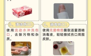 孕妇能用酒精消毒吗_孕期酒精消毒安全指南