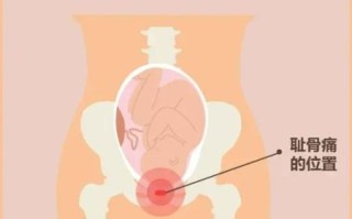 孕妇大腿根疼怎么回事_怎么缓解