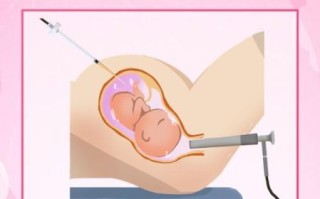 孕妇做羊水穿刺对胎儿有影响吗_羊水穿刺风险大不大