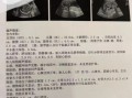 孕妇心脏彩超几周做最合适_心脏彩超最佳孕周