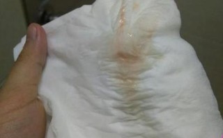 孕妇见红后多久会生_临产见红图片真实表现