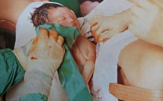孕妇分娩全过程_分娩图片真实记录