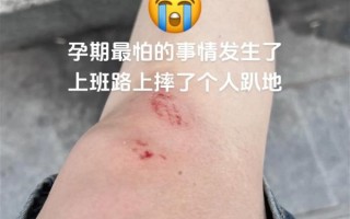 孕妇梦见自己摔倒没事_孕妇梦见摔倒预示什么