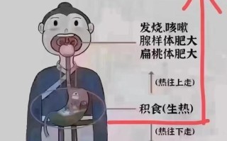 孕妇胃积食难受怎么办_缓解方法有哪些