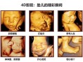 孕妇四维彩超最佳时间_几周做最合适