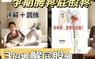 孕妇屁股疼怎么办_孕妇屁股疼怎么缓解