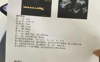 孕妇sd值是什么意思_孕妇sd值偏高怎么办