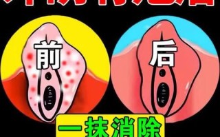 孕妇下面痒怎么办_孕妇外阴瘙痒用什么药