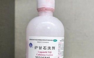 孕妇有湿疹用什么药_孕妇湿疹能涂什么药膏