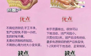 顺产好还是剖腹产好_孕妇怎么选