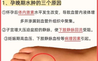 孕妇肿是怎么回事_如何快速消肿