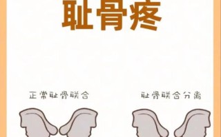 孕妇耻骨痛怎么缓解_耻骨联合痛缓解方法