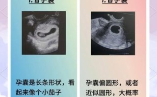 孕妇梦见捡鸡蛋是什么意思_孕妇梦见捡鸡蛋生男生女