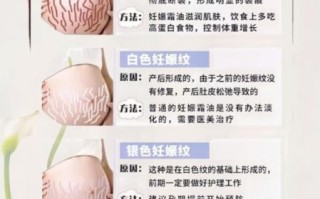孕妇纹怎么消除_孕妇纹什么时候开始出现