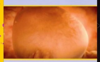 孕妇梦见包子生男生女_胎梦准不准