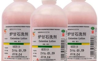 孕妇能用炉甘石洗剂吗_孕期皮肤痒怎么办