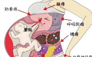 孕妇肚皮撑的疼怎么办_孕晚期肚皮紧绷怎么缓解