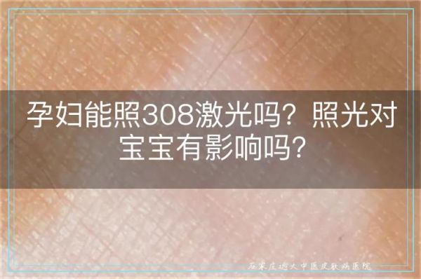 孕妇可以做激光手术吗_孕期激光手术风险-第3张图片-星辰妙记