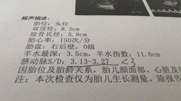 孕妇sd值正常范围_脐动脉sd偏高怎么办-第2张图片-星辰妙记 孕妇sd值正常范围_脐动脉sd偏高怎么办-第2张图片-星辰妙记