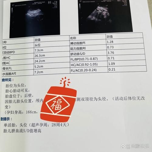 孕妇sd值正常范围_脐动脉sd偏高怎么办-第3张图片-星辰妙记 孕妇sd值正常范围_脐动脉sd偏高怎么办-第3张图片-星辰妙记