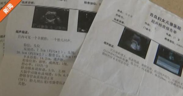 为什么说有钱难买孕妇B_孕妇B超预约难怎么办-第2张图片-星辰妙记 为什么说有钱难买孕妇B_孕妇B超预约难怎么办-第2张图片-星辰妙记