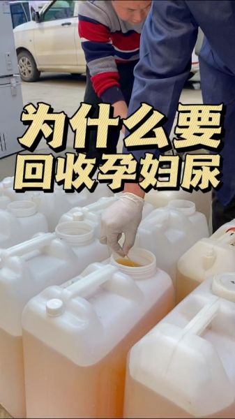 孕妇尿液味道很重_正常吗-第1张图片-星辰妙记