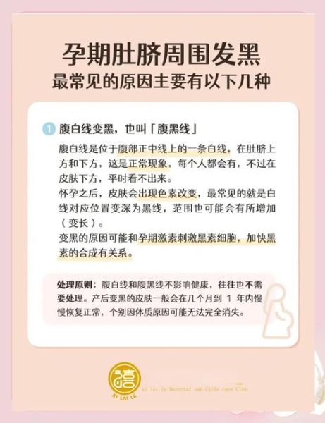孕妇肚脐眼黑是什么原因_孕妇肚脐发黑怎么改善-第2张图片-星辰妙记