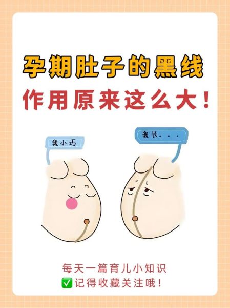 孕妇肚脐眼黑是什么原因_孕妇肚脐发黑怎么改善-第1张图片-星辰妙记