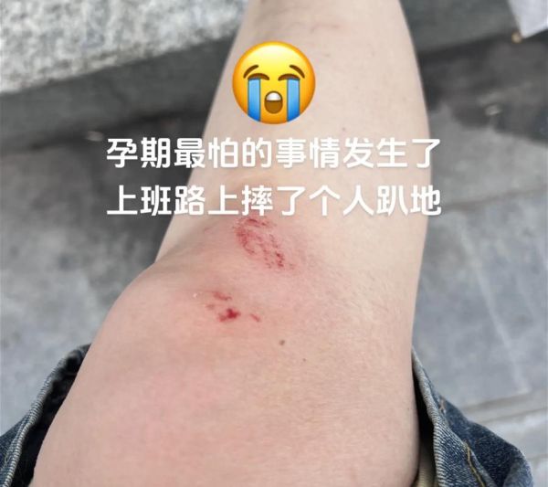 孕妇梦见自己摔倒没事_孕妇梦见摔倒预示什么-第1张图片-星辰妙记