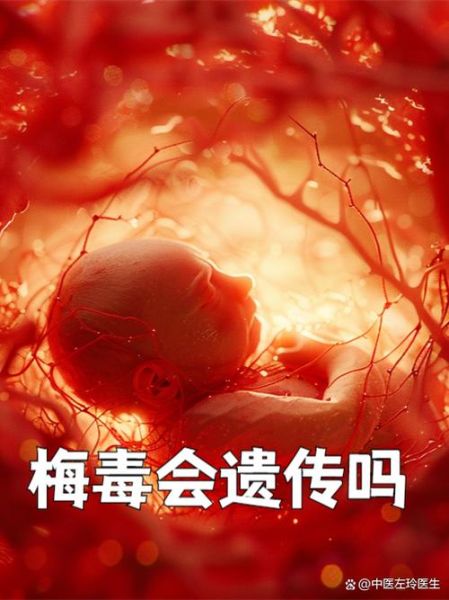 孕妇为什么容易感染梅毒_梅毒对胎儿的影响-第1张图片-星辰妙记