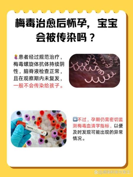 孕妇为什么容易感染梅毒_梅毒对胎儿的影响-第3张图片-星辰妙记
