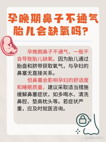孕妇鼻塞胎儿会缺氧吗_孕期鼻炎影响宝宝吗-第2张图片-星辰妙记