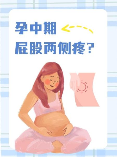 孕妇屁股疼怎么办_孕妇屁股疼怎么缓解-第2张图片-星辰妙记