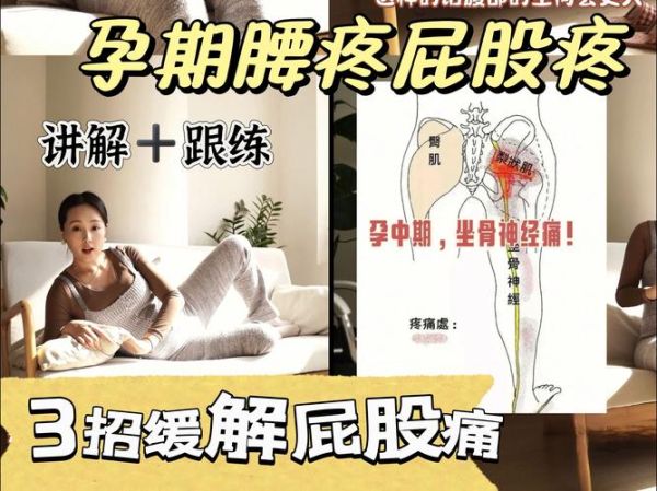 孕妇屁股疼怎么办_孕妇屁股疼怎么缓解-第1张图片-星辰妙记