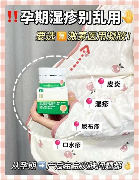 孕妇能用除湿止痒软膏吗_对胎儿有影响吗-第1张图片-星辰妙记 孕妇能用除湿止痒软膏吗_对胎儿有影响吗-第1张图片-星辰妙记