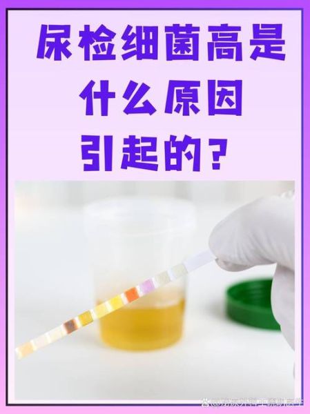 孕妇尿检细菌高是怎么回事_对胎儿有影响吗-第1张图片-星辰妙记