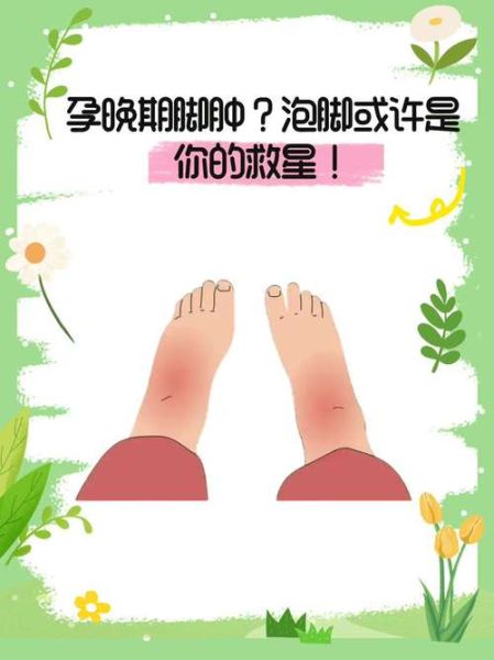 孕妇脚变大了怎么回事_脚肿还是真的长脚-第1张图片-星辰妙记