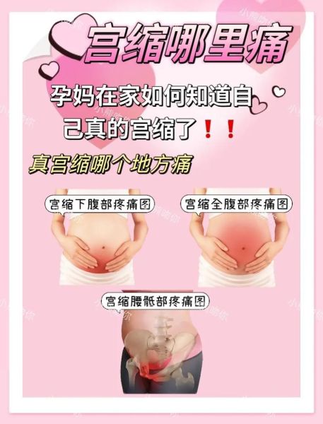 孕妇肚子一阵一阵疼是怎么回事_临产宫缩还是假性宫缩-第2张图片-星辰妙记