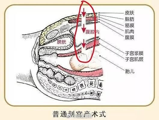 孕妇37周可以剖腹产吗_37周剖腹产对胎儿有影响吗-第3张图片-星辰妙记 孕妇37周可以剖腹产吗_37周剖腹产对胎儿有影响吗-第3张图片-星辰妙记