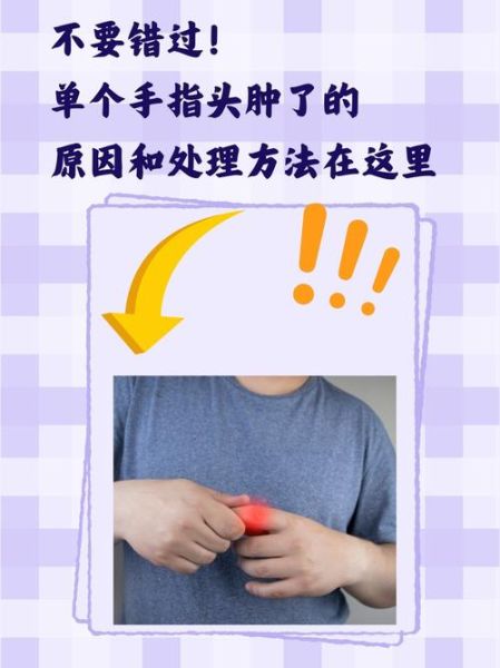 孕妇手肿是什么原因_孕晚期手指肿胀怎么缓解-第1张图片-星辰妙记