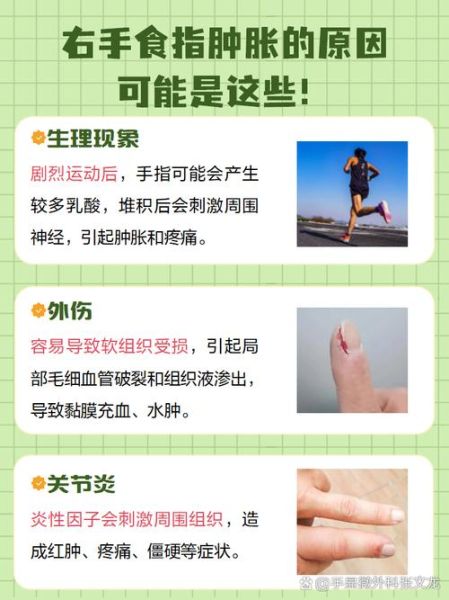 孕妇手肿是什么原因_孕晚期手指肿胀怎么缓解-第2张图片-星辰妙记