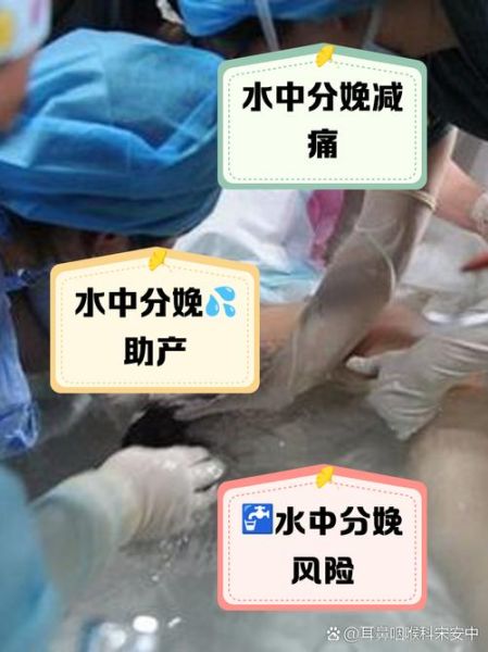 孕妇水中分娩安全吗_水中分娩的好处和坏处-第1张图片-星辰妙记