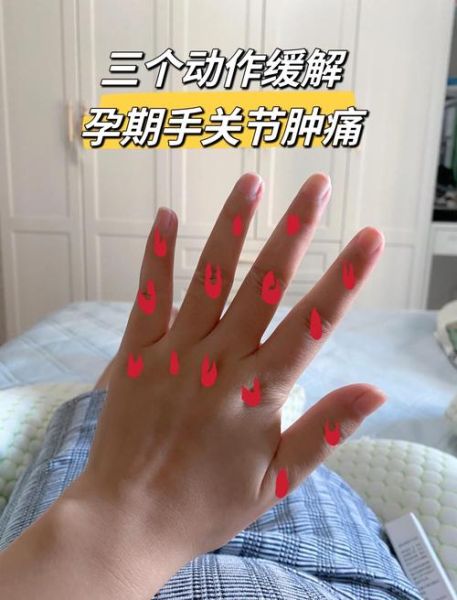 孕妇指关节疼怎么回事_如何缓解-第1张图片-星辰妙记