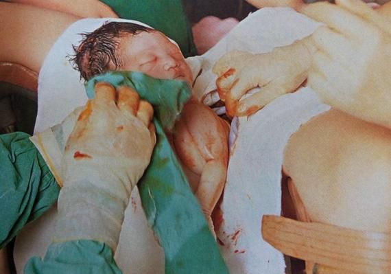 孕妇分娩全过程_分娩图片真实记录-第1张图片-星辰妙记