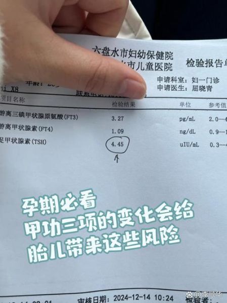 孕妇甲状腺功能异常对胎儿有什么影响_孕期甲状腺检查怎么做-第2张图片-星辰妙记