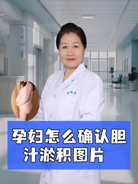 孕妇胆汁淤积能治好吗_对胎儿影响大吗-第1张图片-星辰妙记