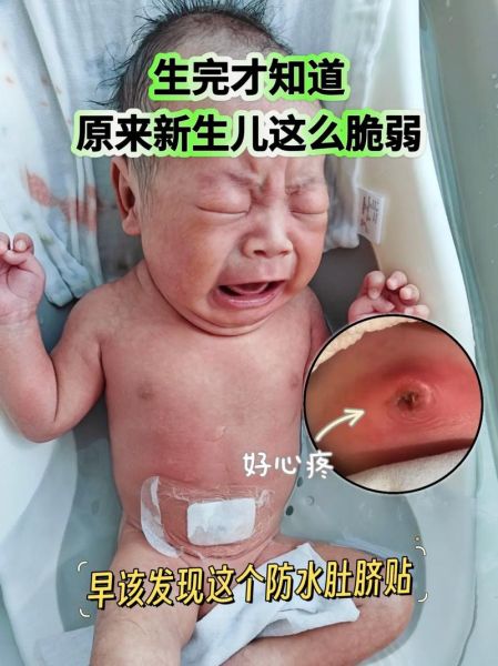 孕妇肚脐突出正常吗_孕期肚脐护理怎么做-第2张图片-星辰妙记