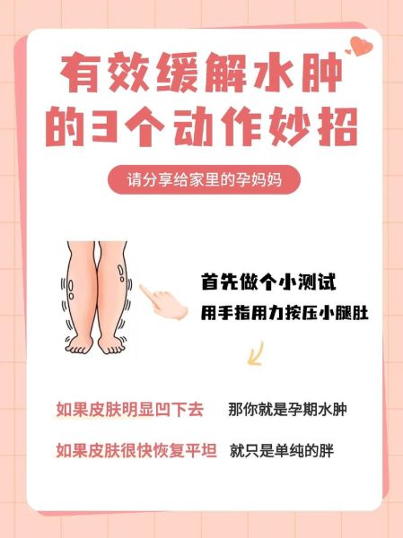 孕妇水肿是什么原因_如何缓解-第1张图片-星辰妙记 孕妇水肿是什么原因_如何缓解-第1张图片-星辰妙记
