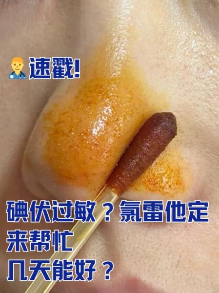孕妇可以擦碘伏吗_碘伏对胎儿有影响吗-第3张图片-星辰妙记